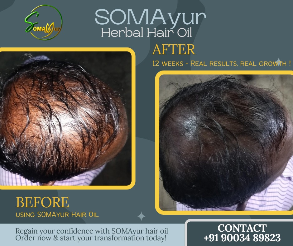 Somayur-Herbal-Hair-Oil3